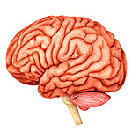 Endovascular Neurosurgery