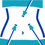 Laparoscopic Minimally Invasive