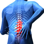 Spine Surgery in India